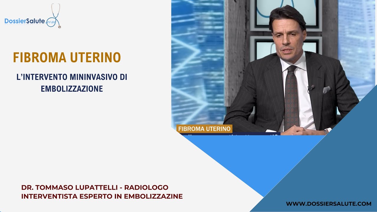 Fibroma uterino: l'intervento mininvasivo di embolizzazione - Dr. Tommaso Lupattelli