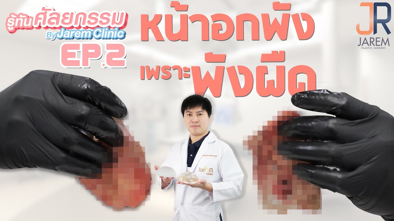 พังผืด ตัวร้ายเสริมหน้าอก -รู้ทันศัลยกรรม EP2-Jarem clinic