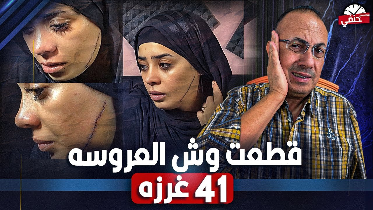 طــلـيقة العريس قـ ـطـ ـعـ ـت وش العروسه بـ41 غرزه قمة البلطجه.مأساة عروسة مصر القديمه (تربية وسخه )
