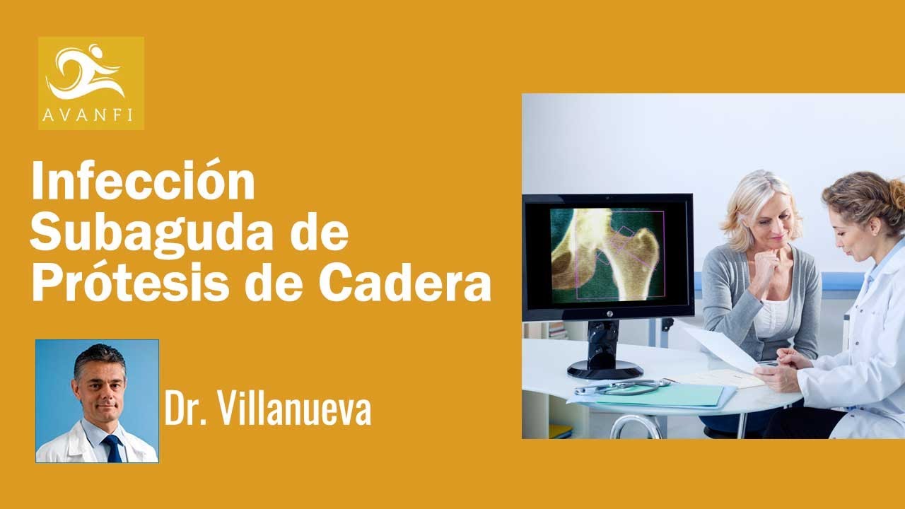 Infección Subaguda en Prótesis de Cadera | Dr. Manuel Villanueva.