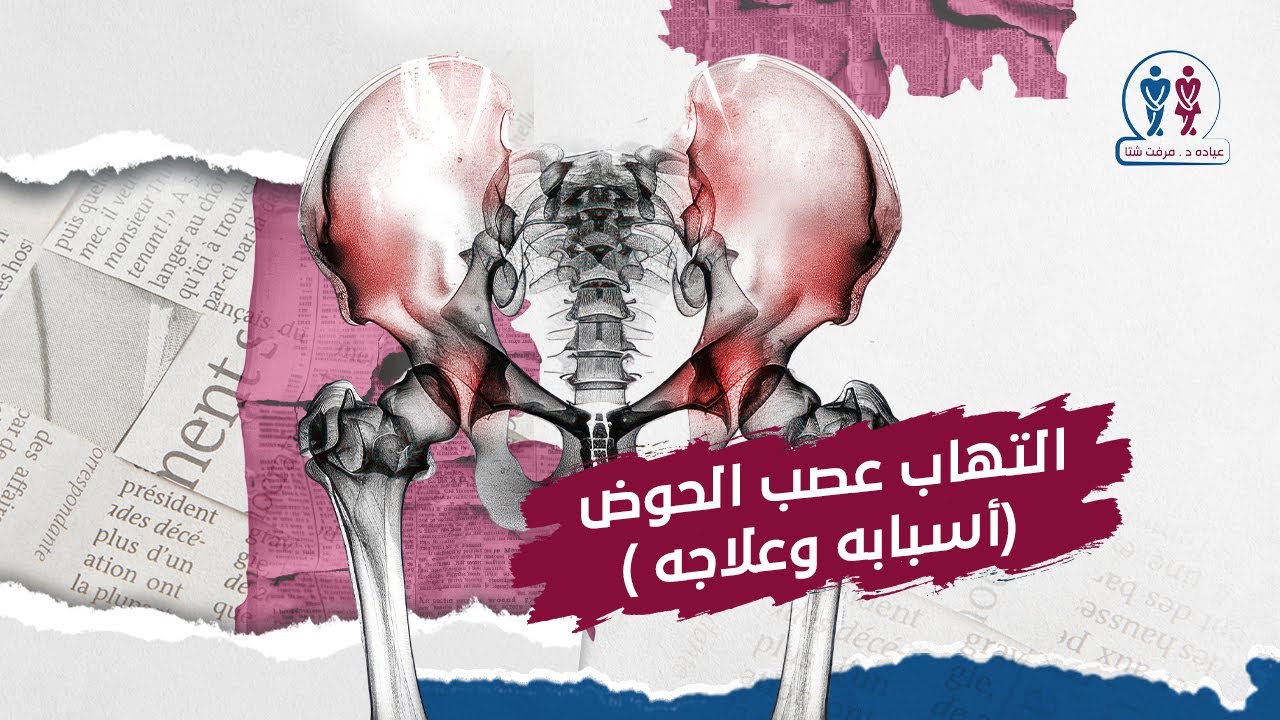 التهاب عصب الحوض ( أسبابه و علاجه) د.مرفت شتا