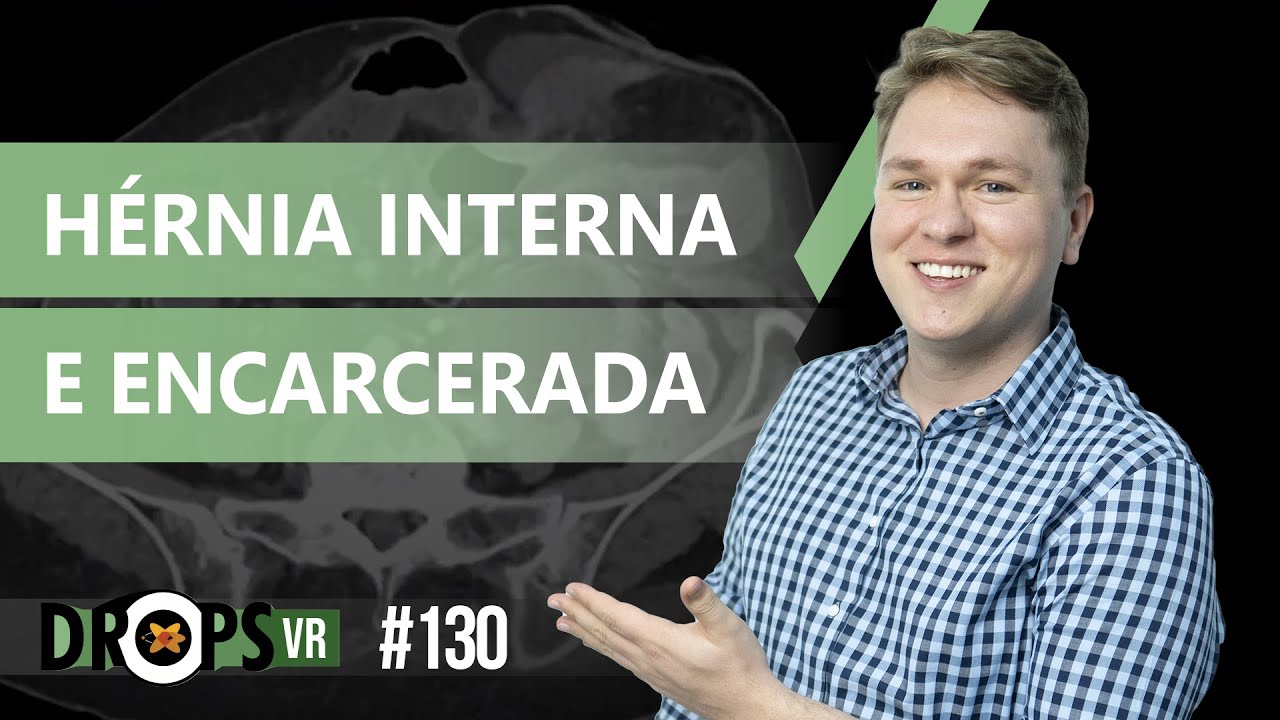 HÉRNIA INTERNA E HÉRNIA ENCARCERADA