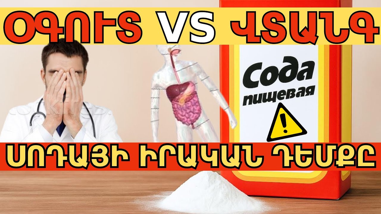 Սոդան բուժում՞, թե սպանում է ։