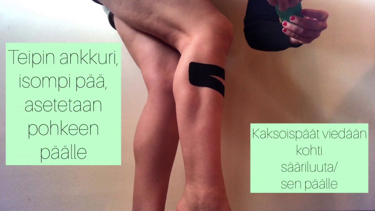 Y-TEIPPAUS, penikoiden teippaus