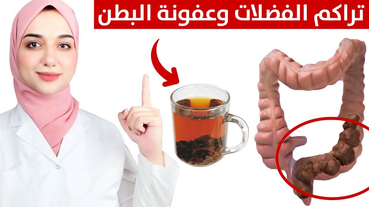 علاج فوري للامساك الشديد و القولون العصبي بعد استخدام هذه الوصفة ...