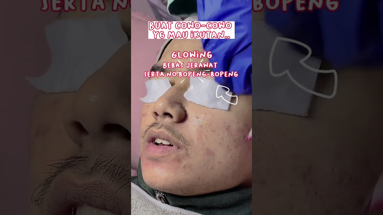 Treatment Buat Cowo-Cowo Yang Mau Ikutan Glowing | Lavees Clinic