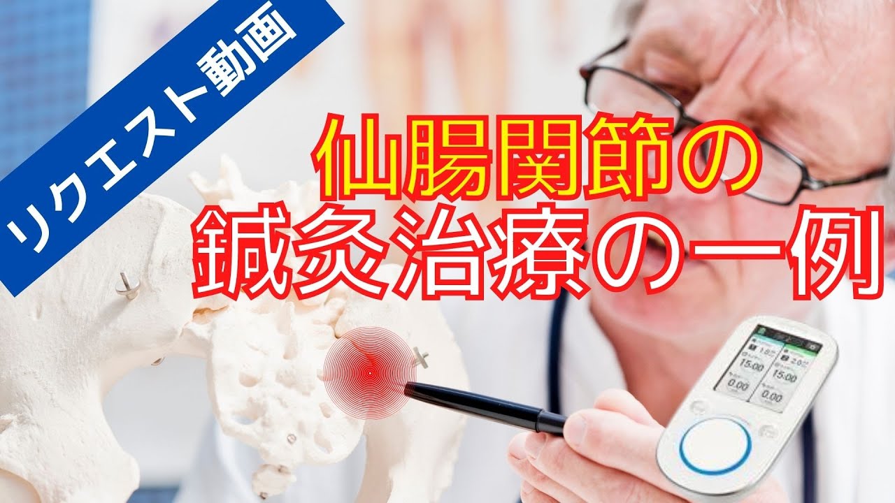 仙腸関節部の刺鍼法｜リクエスト動画