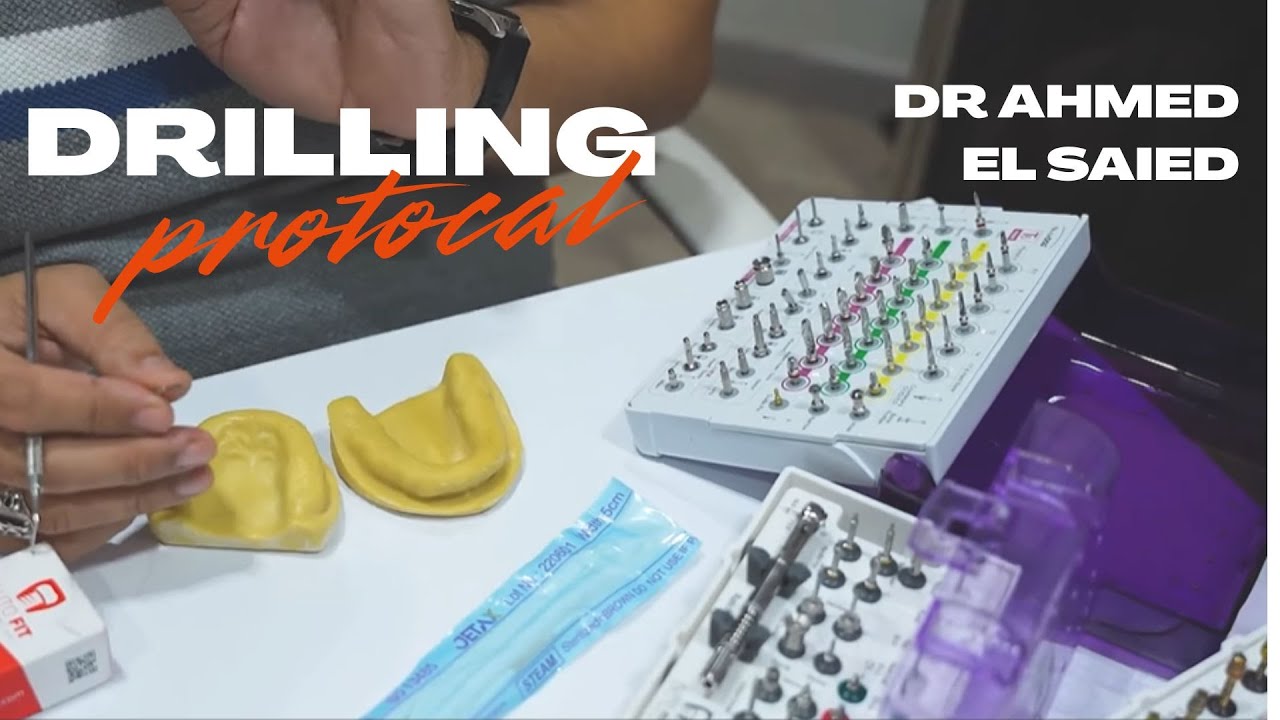 Dental Implant Drilling Protocol on cast