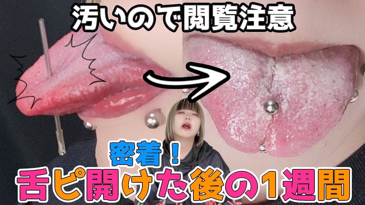 【地獄】舌ピアス開けた後の1週間に未着！