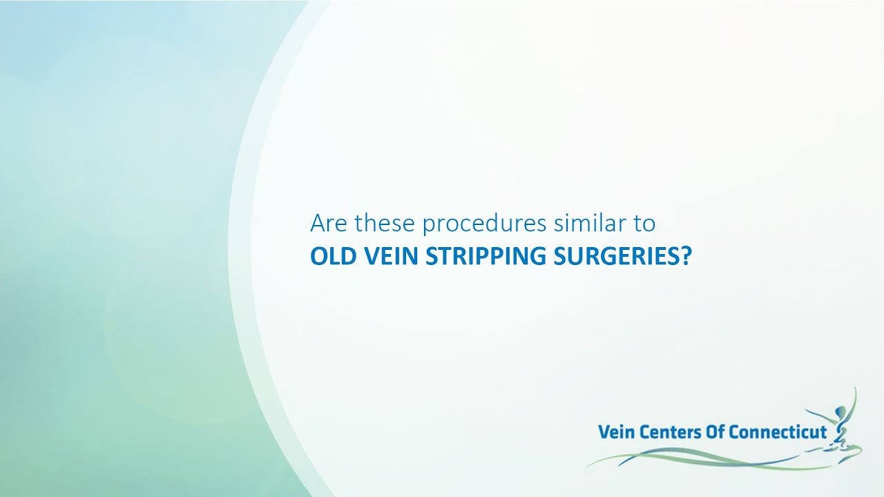 Varicose Vein FAQs | Are These Procedures Like Vein Stripping?