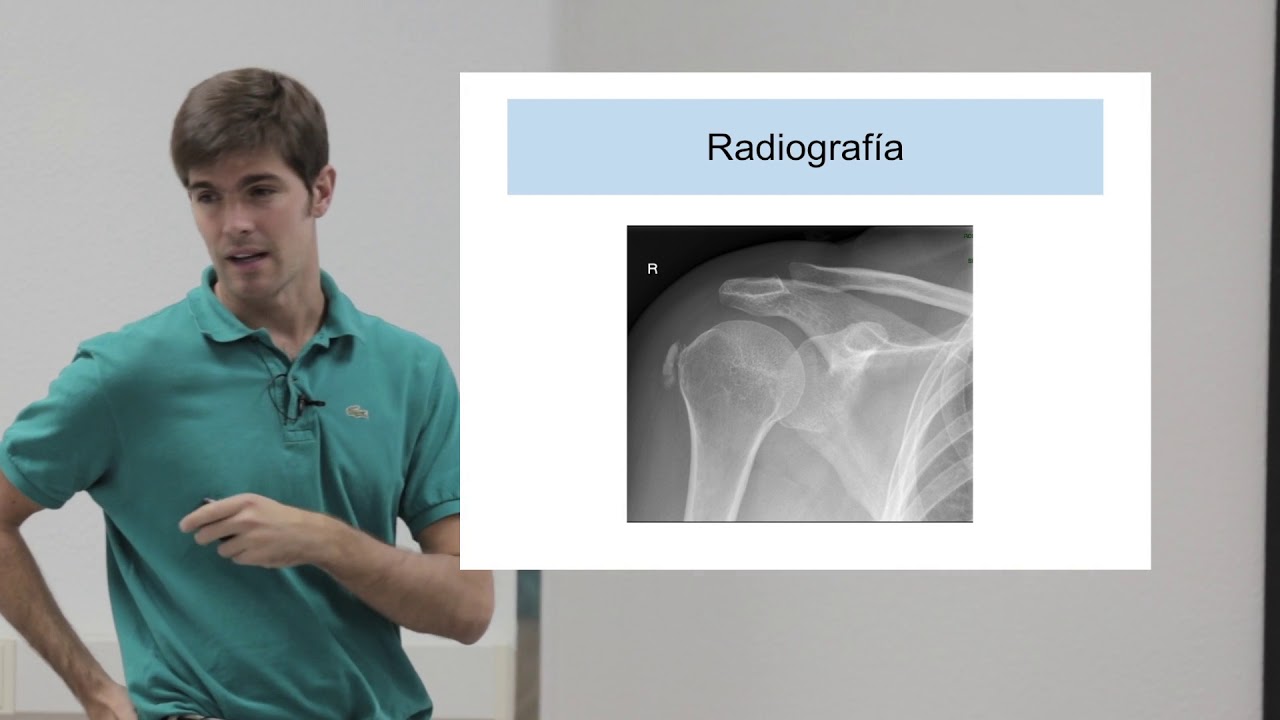 (13-14) Tendinopatía calcificante de hombro