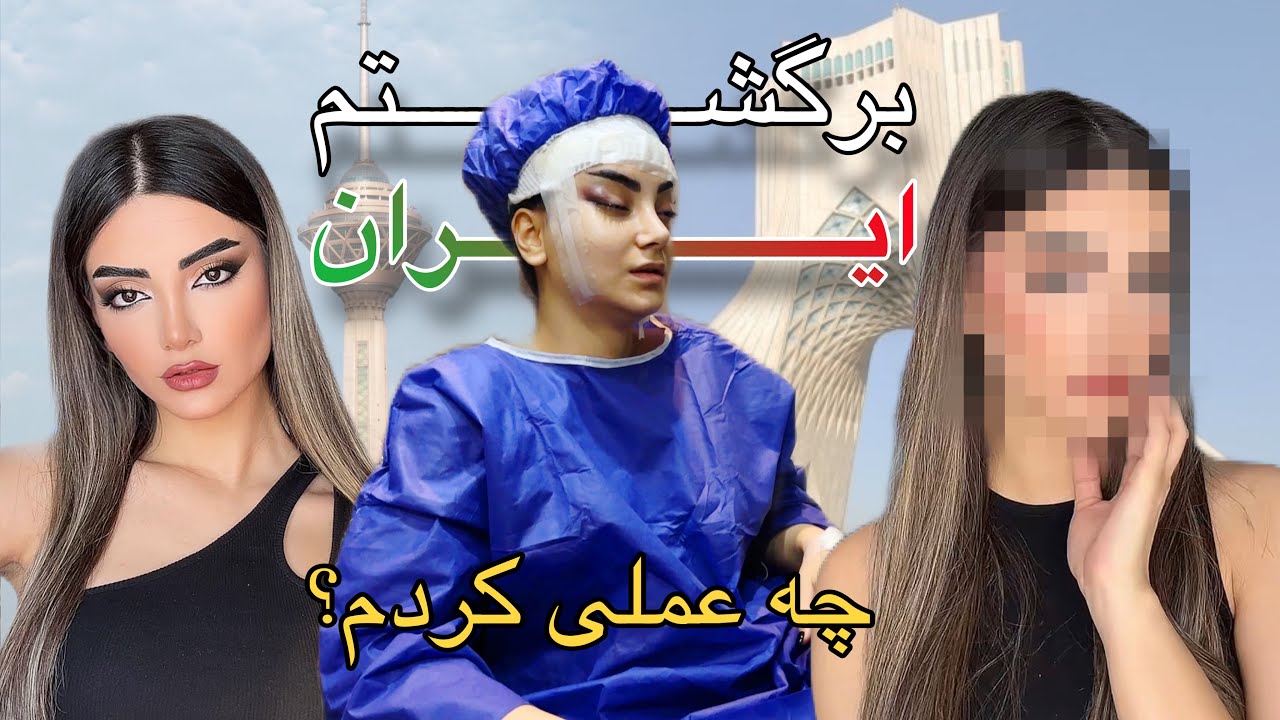 برگشتم ایران عمل لیفت شقیقه کردم 🌍​ IRAN VLOG