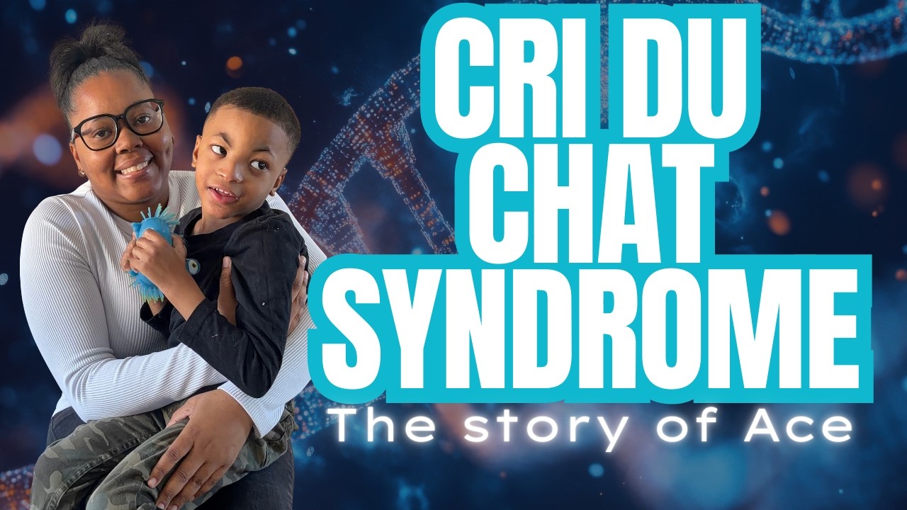 Cri du Chat Syndrome | Marcella & Ace | The Story of Ace