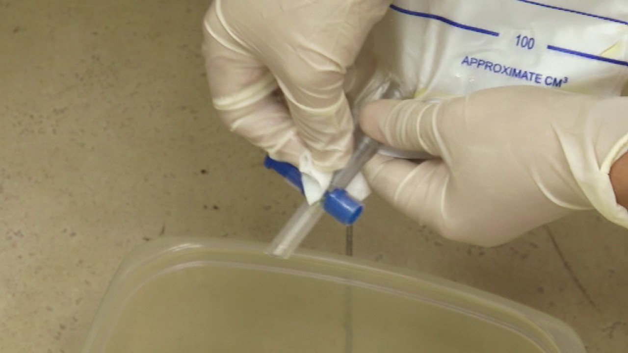 HCA Hospice [Medi Minder Training Series] Changing the Urine Bag
