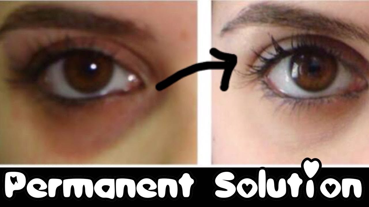 How to Remove Dark Circles Naturally Permanently - in 3 days 😈JSuper Kaur