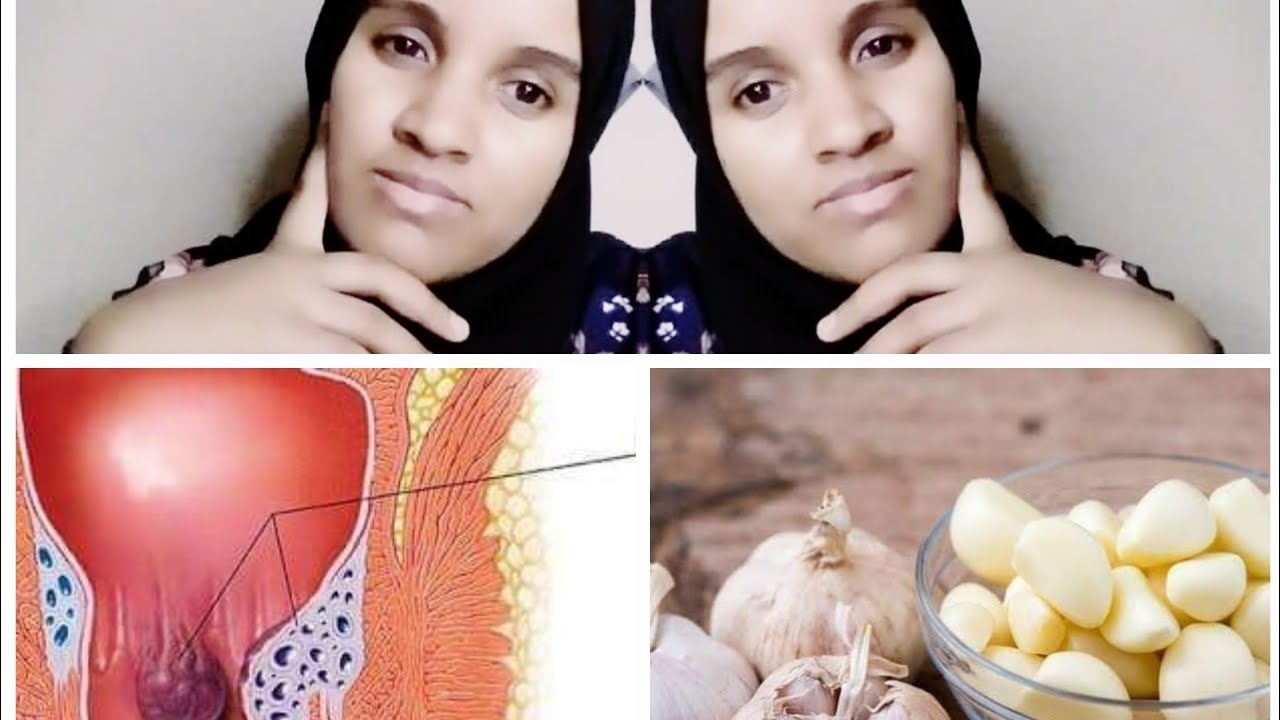 Mallato dhukkuba kitaroti fayyani fayya