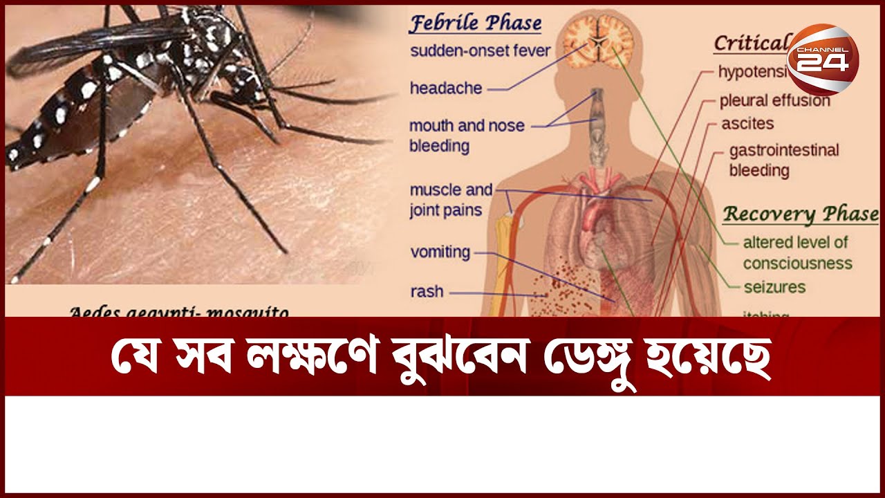যে সব লক্ষণে বুঝবেন ডেঙ্গু হয়েছে | Dengue Symptoms | Channel 24