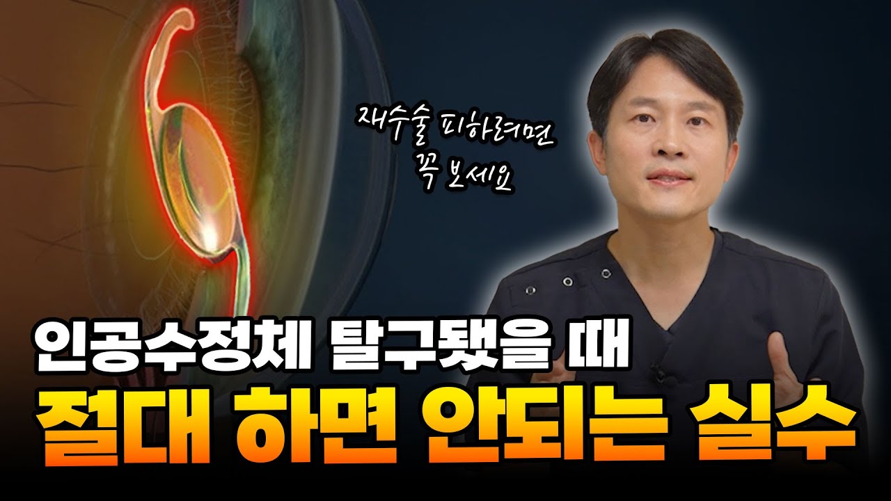 1주일 만에 재탈구..? '공막고정술' 받기 전에 꼭 봐야 할 영상‼ |  MUST WATCH Before Scleral Fixation