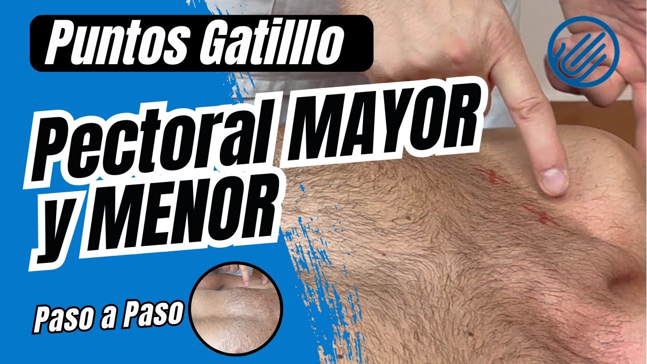 Puntos Gatillo Pectoral MAYOR y MENOR [Terapia MANUAL]