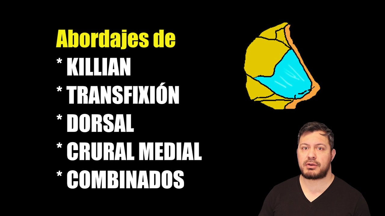 😷 Septo Nasal: abordajes para su REPARACIÓN | Generalidades | Parte 1.