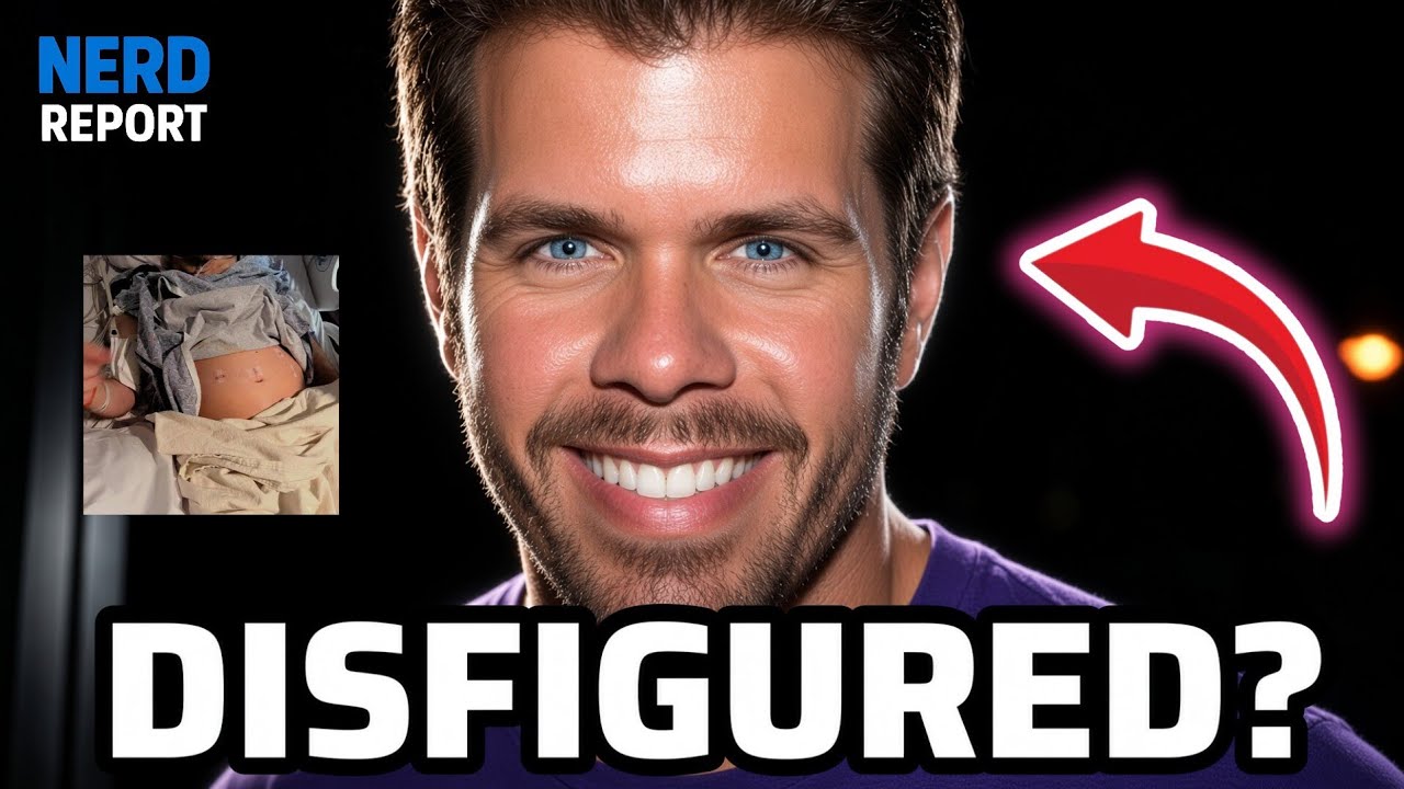 ШОКИРУЮЩИЕ НОВОСТИ О PEREZ HILTON после инцидента во время стрима &mdash; возможное необратимое обезобр...