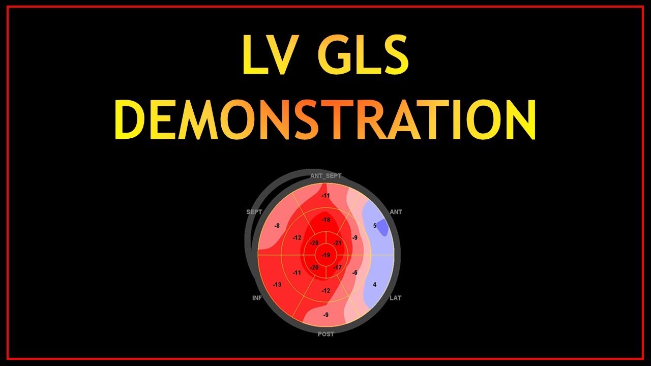 Практическая демонстрация GLS! (ЧАСТЬ 2)