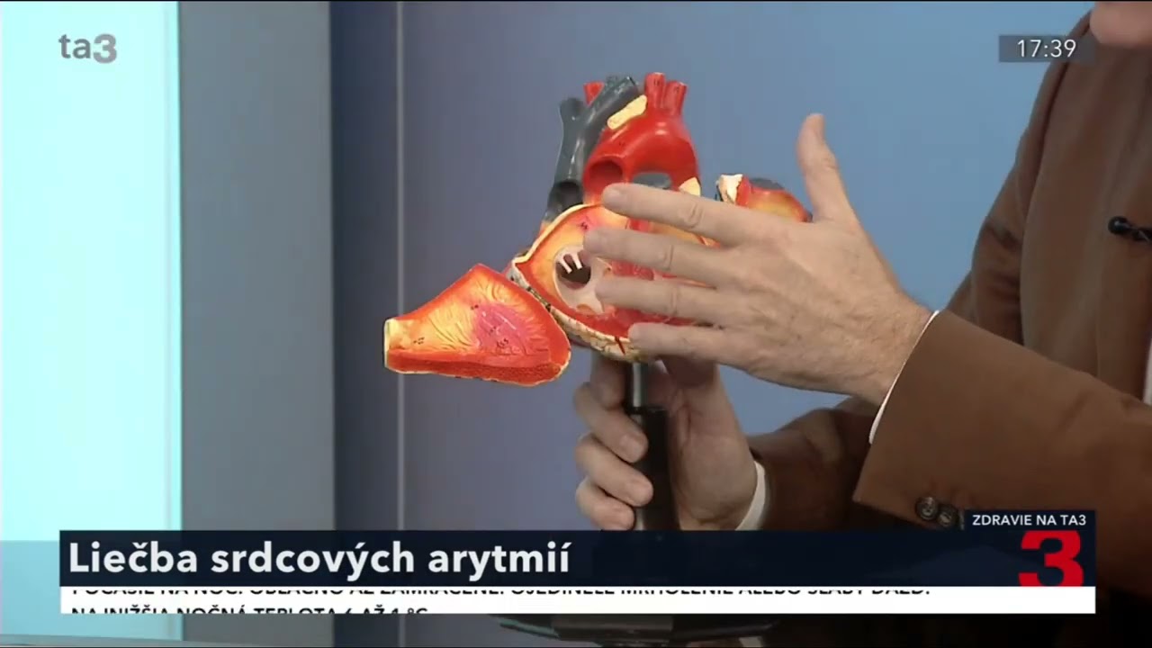 Búšenie srdca, chvíľková nevoľnosť, alebo sťažené dýchanie. Prečo vzniká srdcová arytmia?