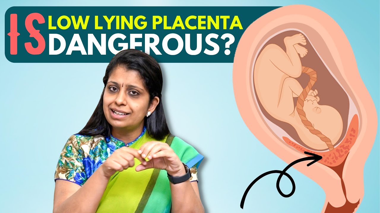 Is Low Lying Placenta Dangerous | கர்ப்ப காலத்தில் நஞ்சுக்கொடி கீழிறங்கினால் ஆபத்தா ?
