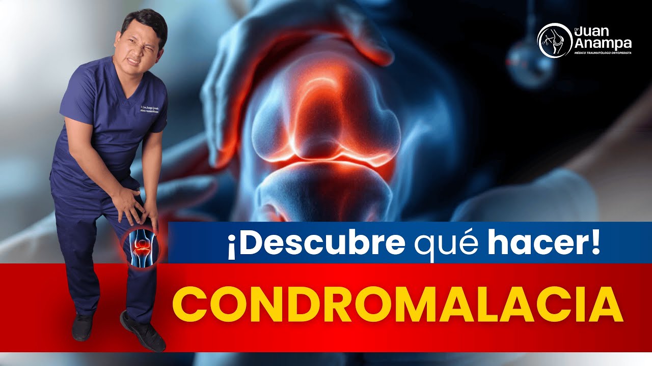 ¡MITOS y VERDADES sobre la CONDROMALACIA! - Dr. Juan Anampa