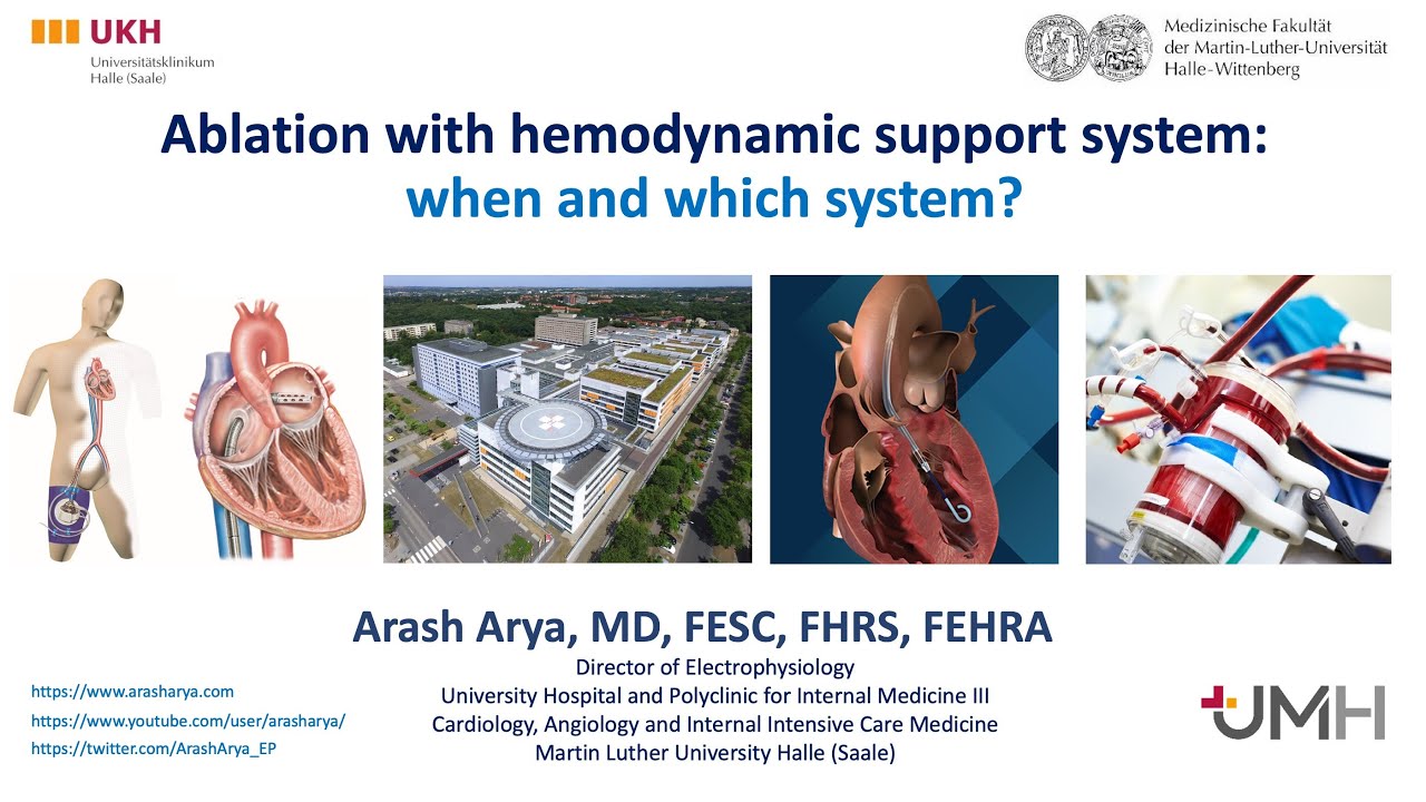 Hemodynamic Support during Ablation of Ventricular Arrhythmias
