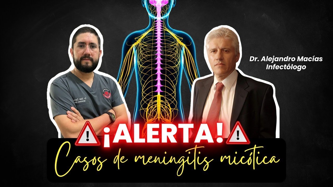 🗞️ Casos de Meningitis por hongos 🇲🇽@Dr. Alejandro Macias