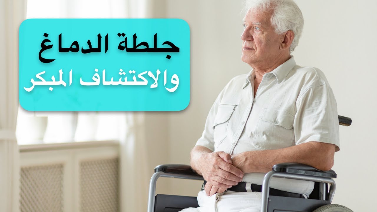 كيف تكتشف جلطة الدماغ أو الفالج بشكل مبكر؟