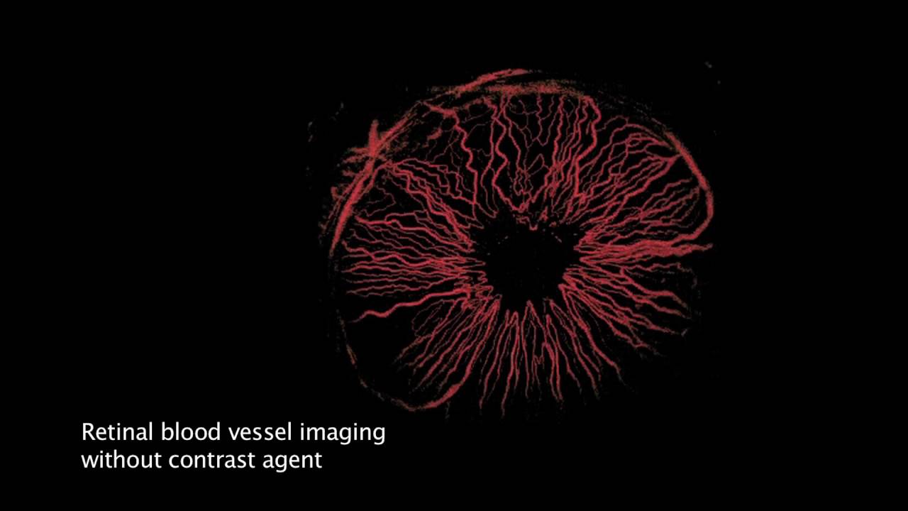 Photoacoustic Imaging BIMA2016