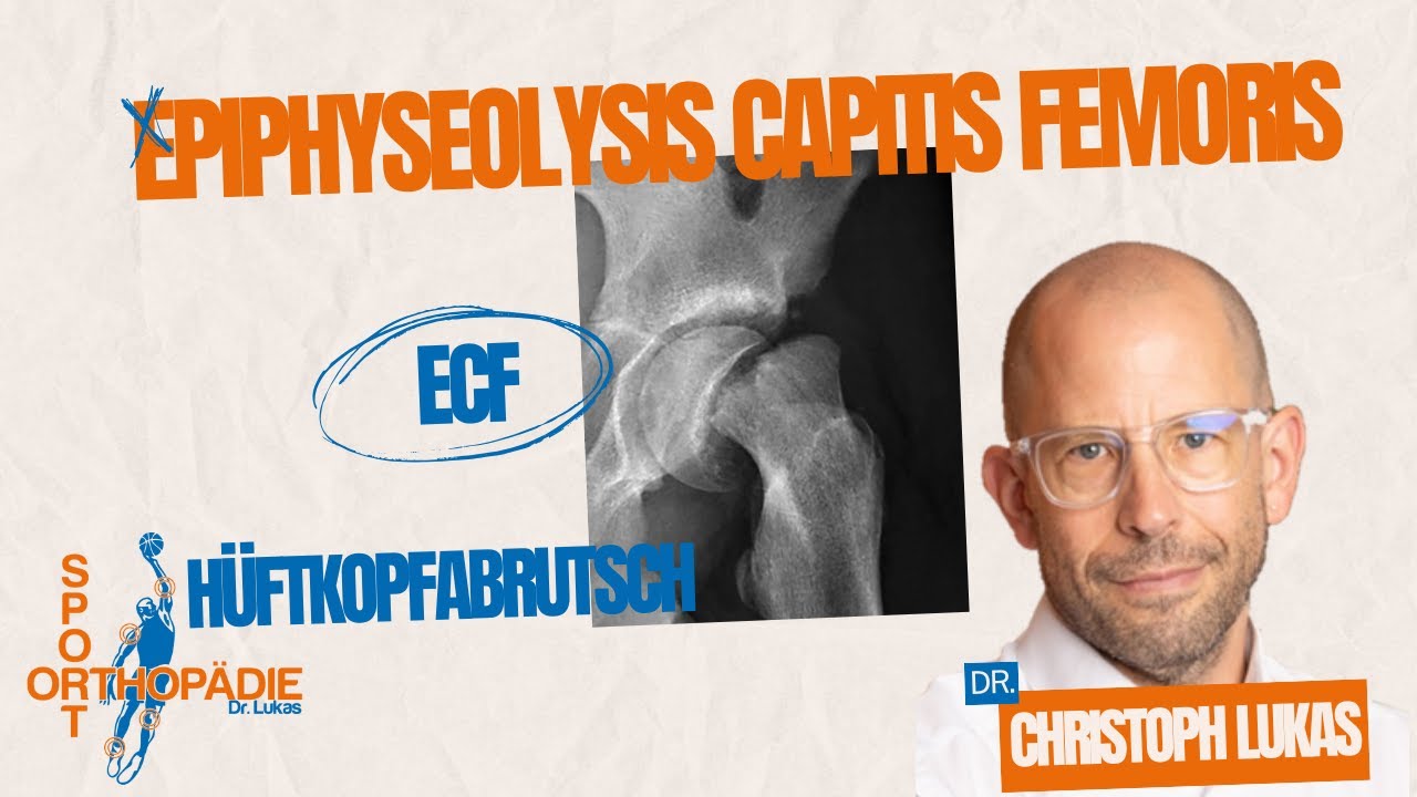 Epiphyseolysis capitis femoris – Wenn der Hüftkopf abrutscht