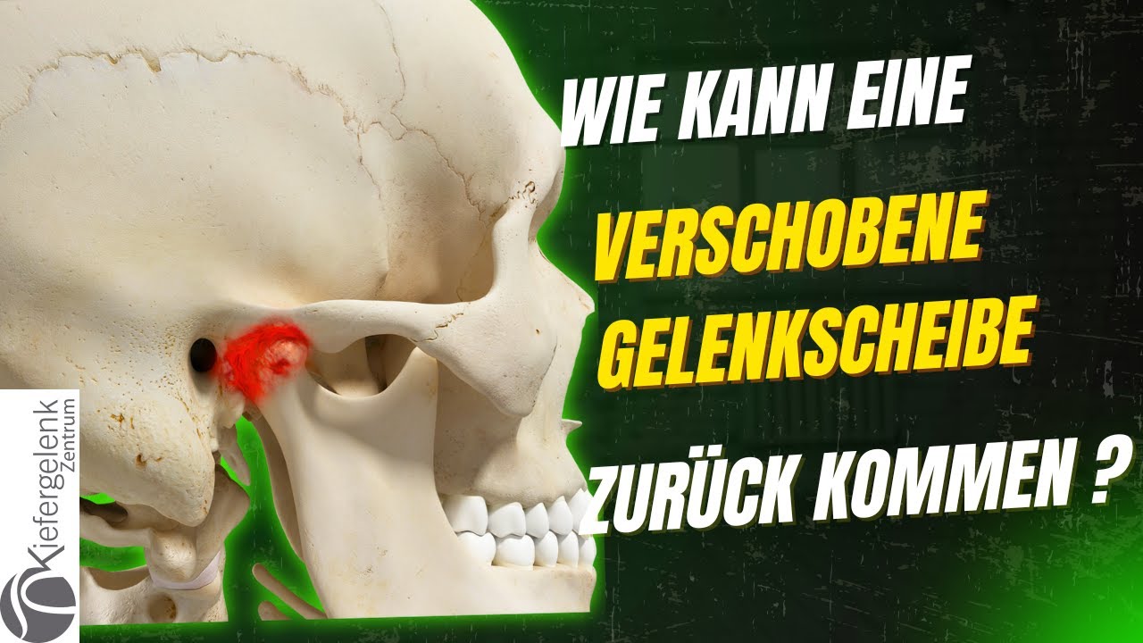 👉 Wie kann eine Kiefergelenksscheibe wieder zurückkommen?