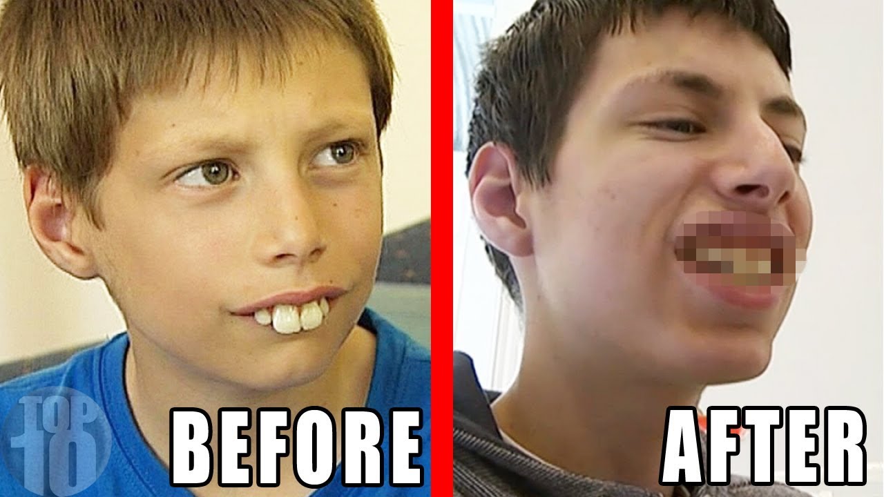 Amazing Before & After Photos