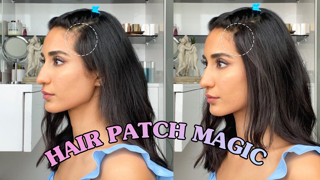 Cover Up Your Bald Spot Using Hair Patch | Hair Thinning Solution | Hairstyle Using Cover-up Patch