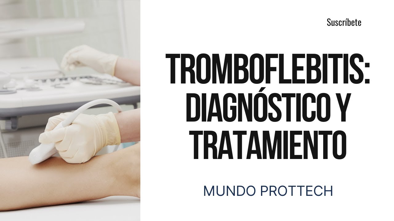 Tromboflebitis, diagn&oacute;stico y tratamiento ‐ #tromboflebitis #flebitis