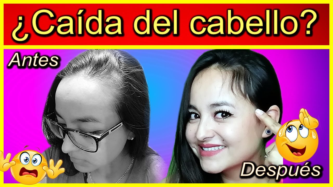 Shampoo de cebolla para la ca&iacute;da del cabello (Shampoo  + cebolla + jengibre + canela + ajo)