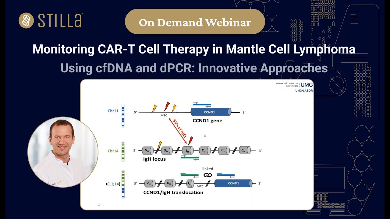 Monitoring CAR T Cell Therapy in Mantle Cell Lymphoma Using cfDNA and dPCR  Innovative Approaches