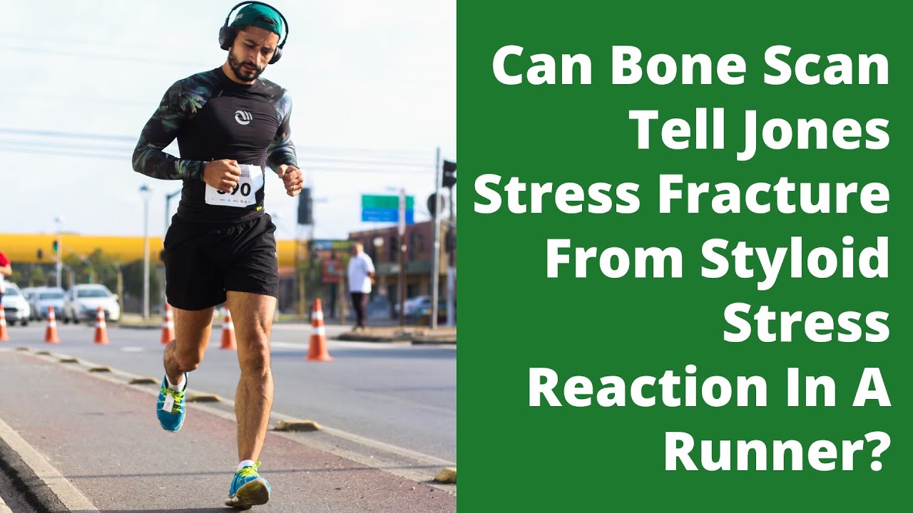 Can Bone Scan Tell Jones Stress Fracture From Styloid Stress Reaction In A Runner?