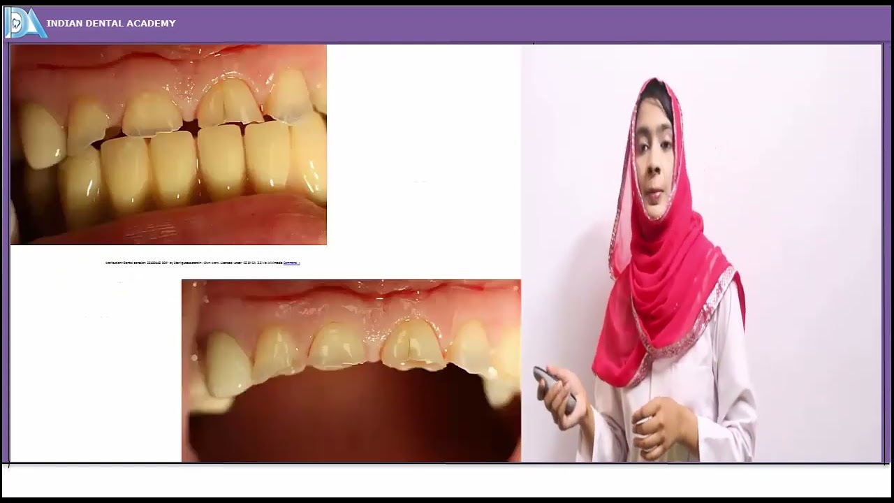 Regressive altrations of teeth