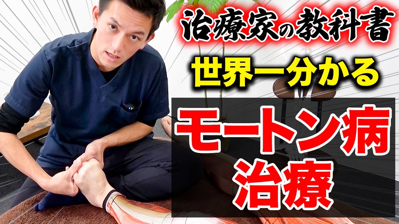 【※治療家必見】世界一分かりやすいモートン病の原因と必須の徒手・運動療法