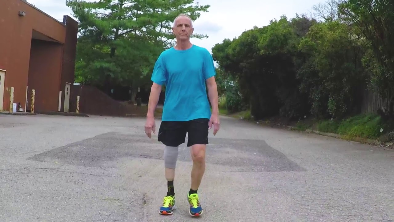 Case Study 4 - Walking with Cheetah® Xplore foot (Anterior-Posterior)