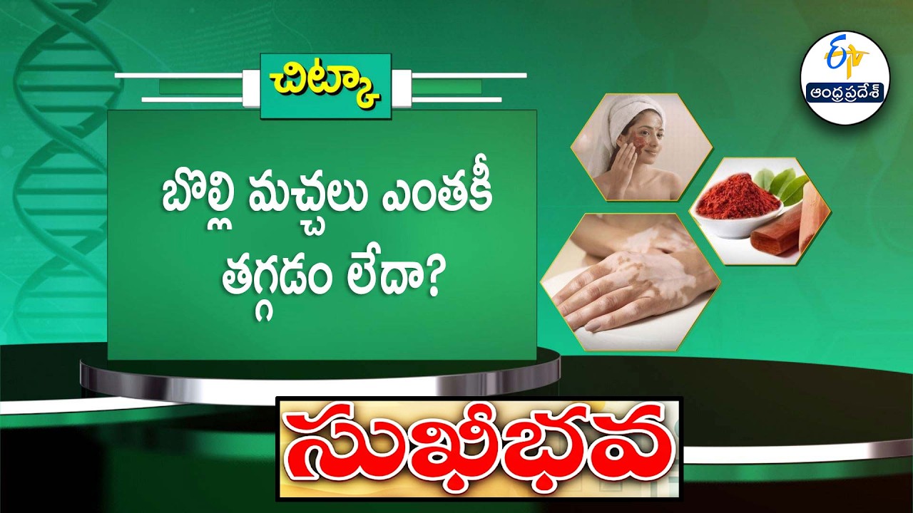 బొల్లి మచ్చలు ఎంతకీ తగ్గడం లేదా ? | Heath Tip to reduce Vitiligo spots | Sukhibhava | ETV AP