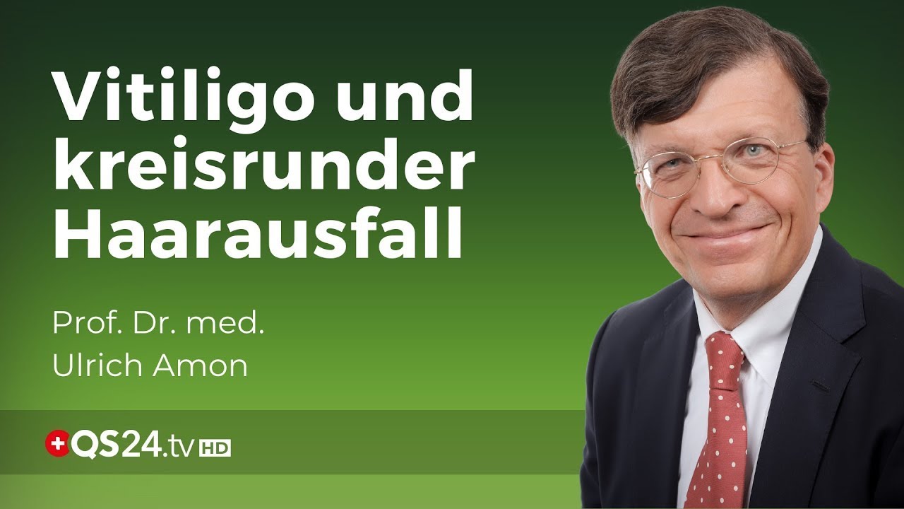 Ursache und Therapie von der Vitiligo-Weissfleckenkrankheit und kreisrundem Haarausfall | @QS24 - Schweizer Gesundheitsfernsehen