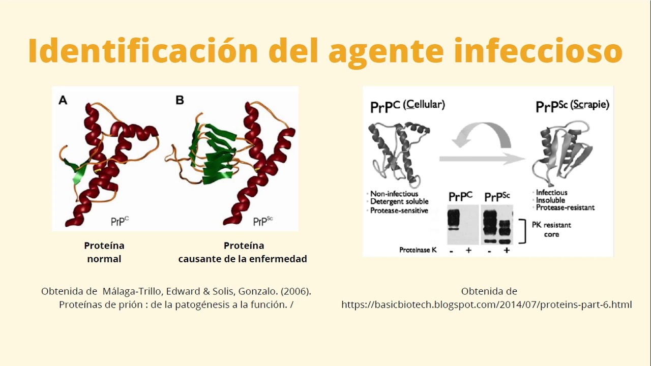 Los priones y enfermedades neurodegenerativas