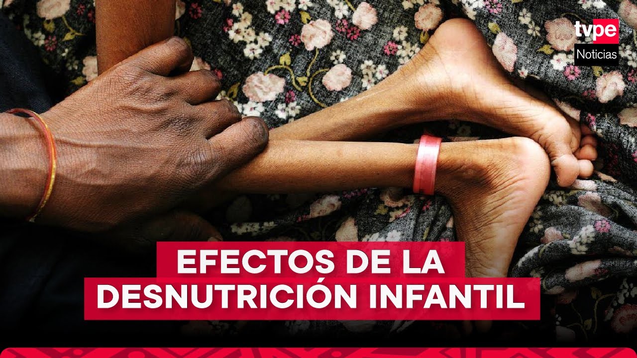 Desnutrici&oacute;n infantil: cu&aacute;les son las causas y consecuencias de esta problem&aacute;tica en el Per&uacute;