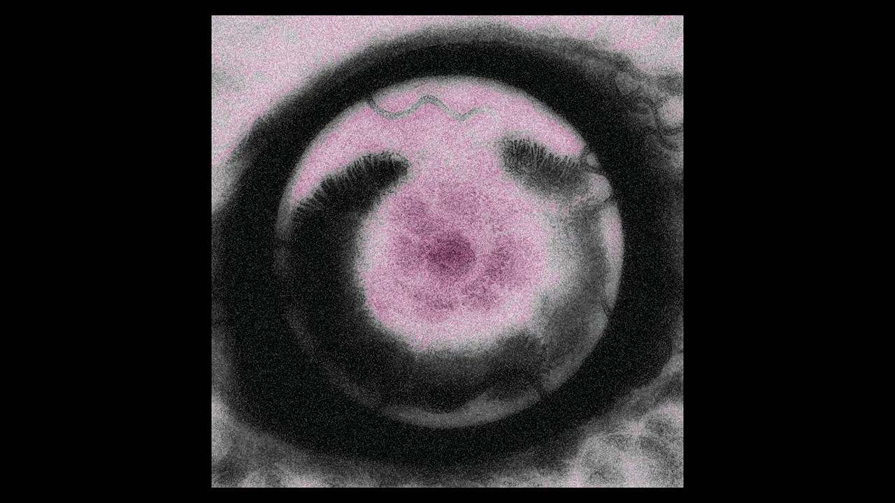 FREE LOOP KIT/SAMPLE PACK – PARASITE / OHSXNTA X CHE X OSAMASON INSPIRED LOOPS