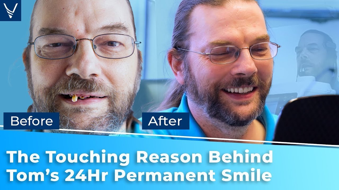Tom's Touching Reason Behind his 24-hour Permanent Smile Decision